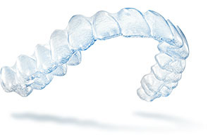 fix crooked teeth with Invisalign clear braces in Addison TX