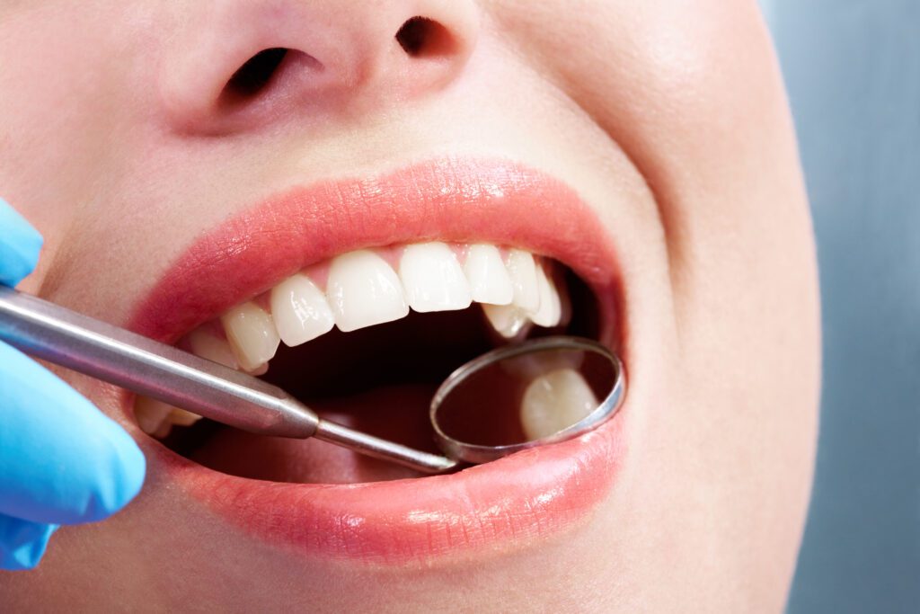 Close-up of a person's mouth with a dental mirror inspecting the gums.