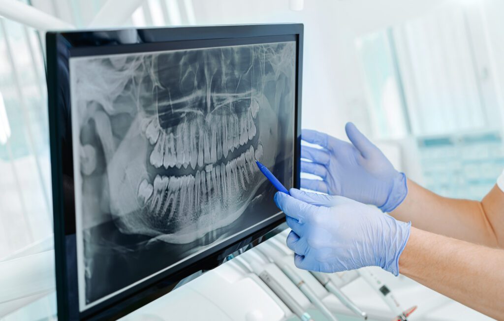 A dentist examining a patient's X-ray.
