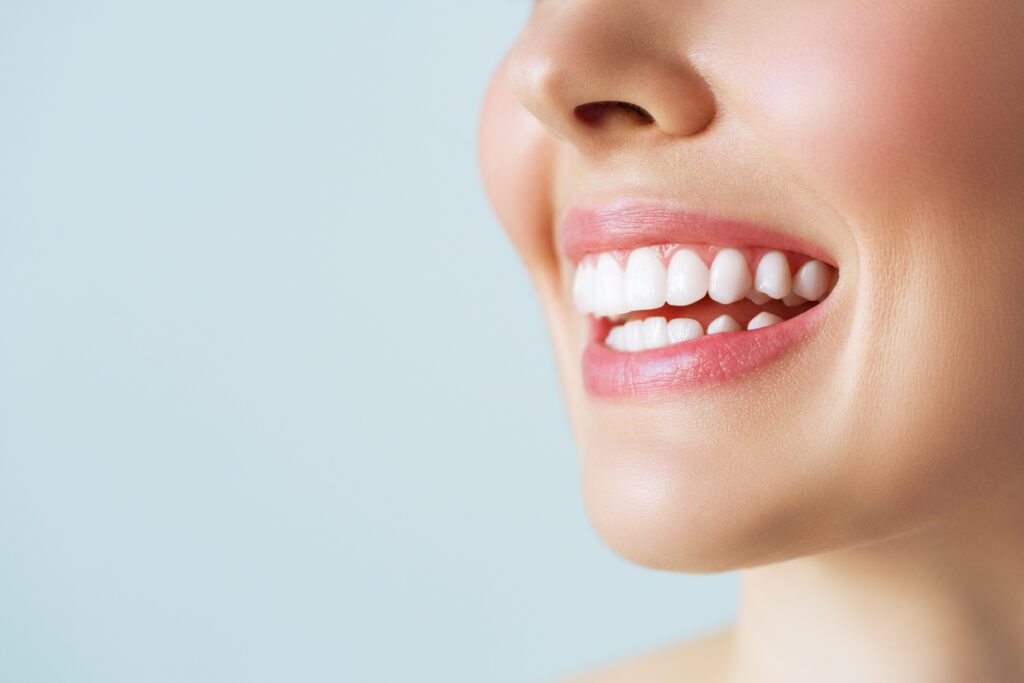 A young woman smiling with prepless veneers.