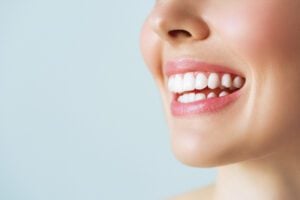 A young woman smiling with prepless veneers.
